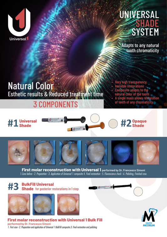 MICERIUM Universal 1 Light Curing Composite Opaque (5g)